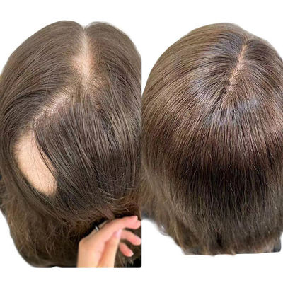 150g Middle Part Female Women'S Toupee Wigs Hair Replacement